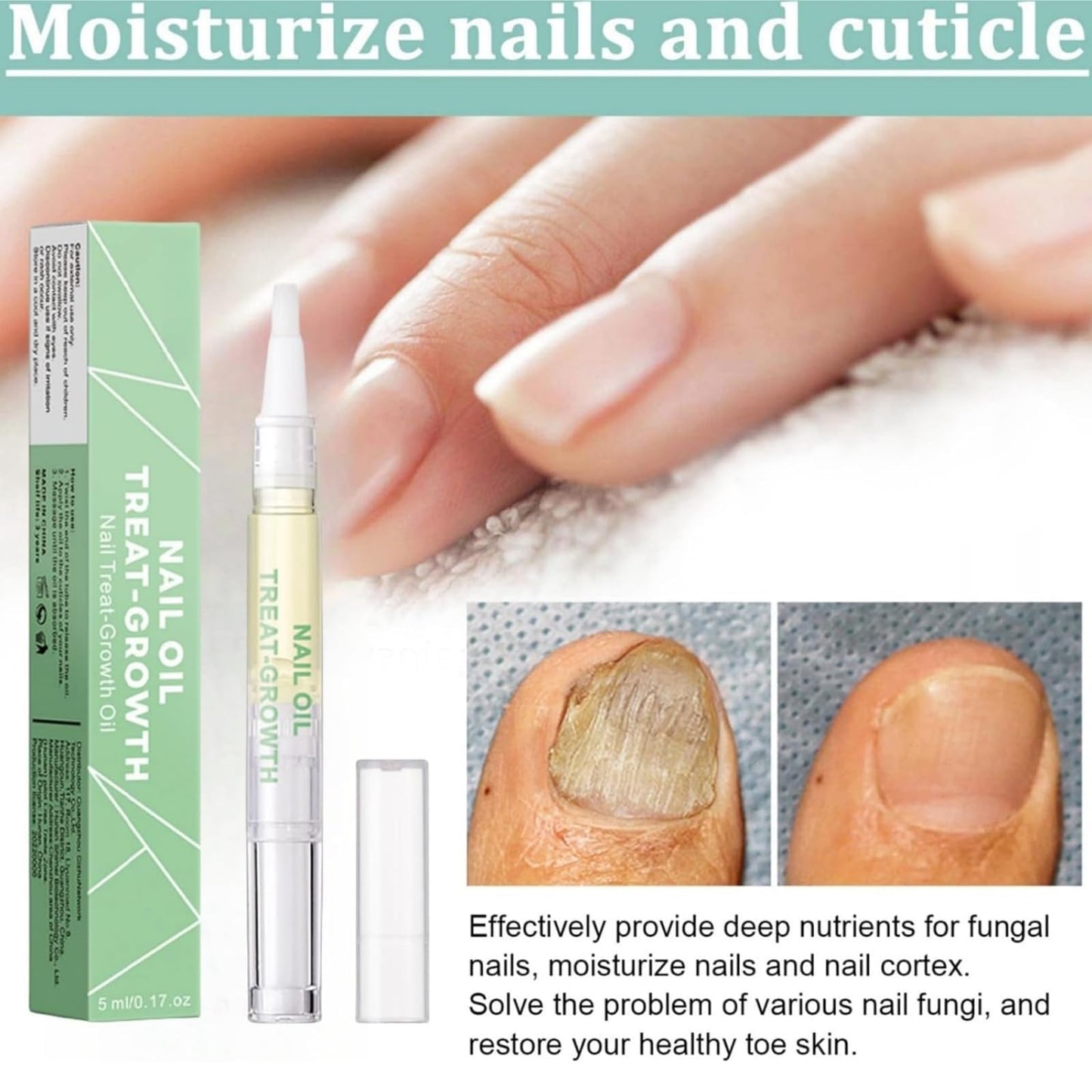 2pcs Radiant Nail Growth Oil,Cuticle Moisturizer & Nail Strengthener with Vitamin E Cuticle N/ail Oi/l,Radiant N/ail Growth O-il Pen,Cuti-cle Oi/l Pen for Nails,Nail-Oil Treatment for Damaged Na-ils