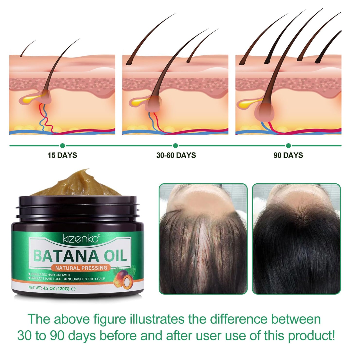 XAYGHE Raw Batana Oil for Hair Growth, Organic Batana Hair Oil Hair Mask for Dry Damaged Hair and Moisturizes Skin, Raw Batana Cream Oil for Healthier, Thicker, Fuller Hair