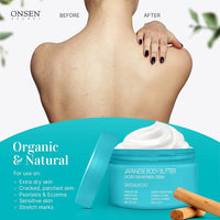 Onsen Secret Japanese Body Butter - Skin Refinery Cream Natural and Organic Moisturizing Clear Skin Exfoliator with All Coconut and Jojoba Oil for Women- 8.6 fl oz/255 ml (Sandalwood)