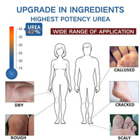 Cureluxe 42% Urea Cream with 2% Salicylic Acid - Foot Moisturiser for Dry,Rough,Cracked Heels - Gentle Exfoliation Urea Foot Cream - Urea Cream 42 Percent for Feet - Multi-Purpose Cracked Heel Repair Cream