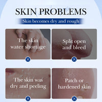 Cureluxe 42% Urea Cream with 2% Salicylic Acid - Foot Moisturiser for Dry,Rough,Cracked Heels - Gentle Exfoliation Urea Foot Cream - Urea Cream 42 Percent for Feet - Multi-Purpose Cracked Heel Repair Cream