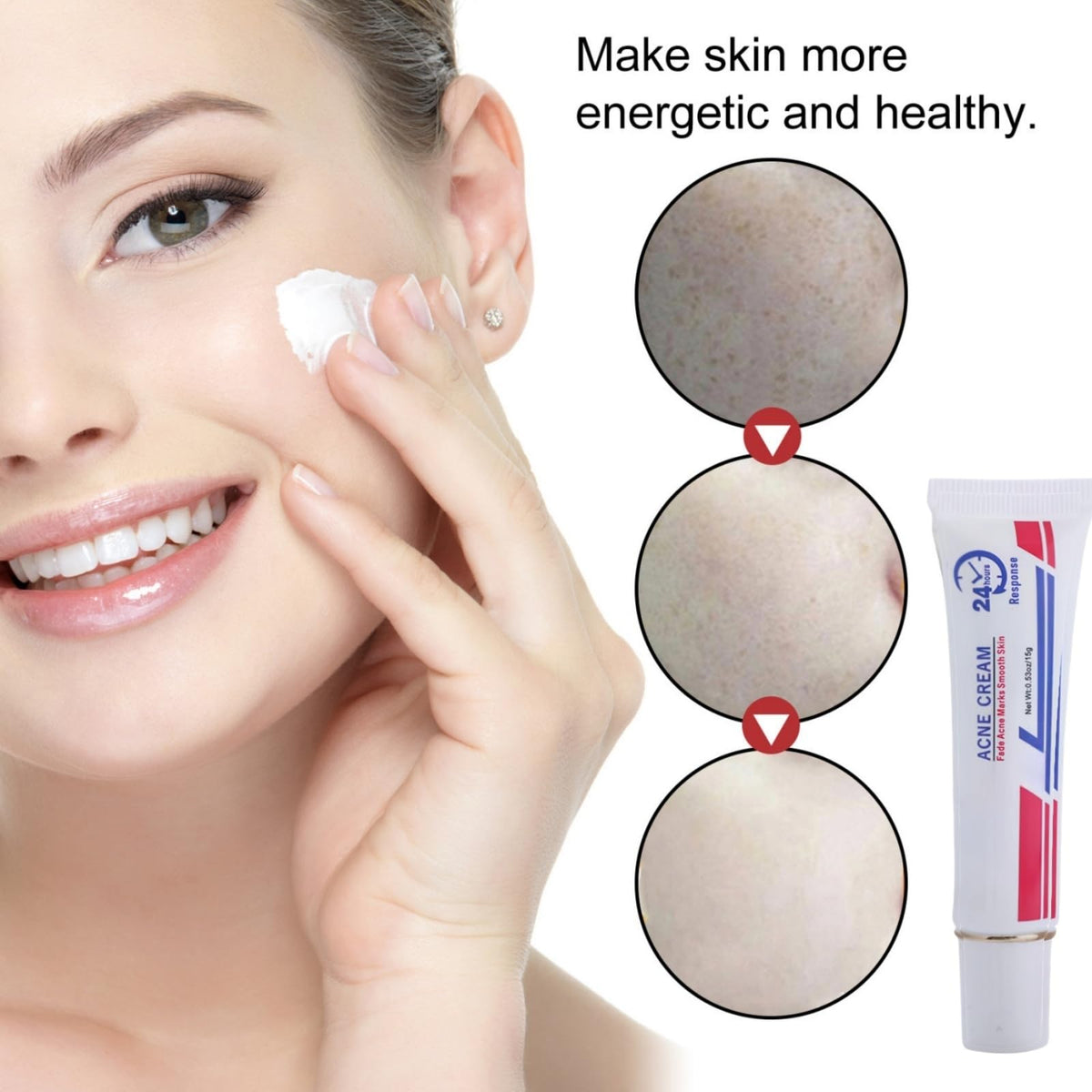 QinZiEn Acid Spot Cream,Acne Treatment for Spot Prone Skin,Acne Scar Treatment,24-Hour Spot Reduction,Acne Cream,Dark Spot Remover for Face,A/nce Scar Removal C/ream,Spot Treat/ment,15g