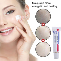 QinZiEn Acid Spot Cream,Acne Treatment for Spot Prone Skin,Acne Scar Treatment,24-Hour Spot Reduction,Acne Cream,Dark Spot Remover for Face,A/nce Scar Removal C/ream,Spot Treat/ment,15g