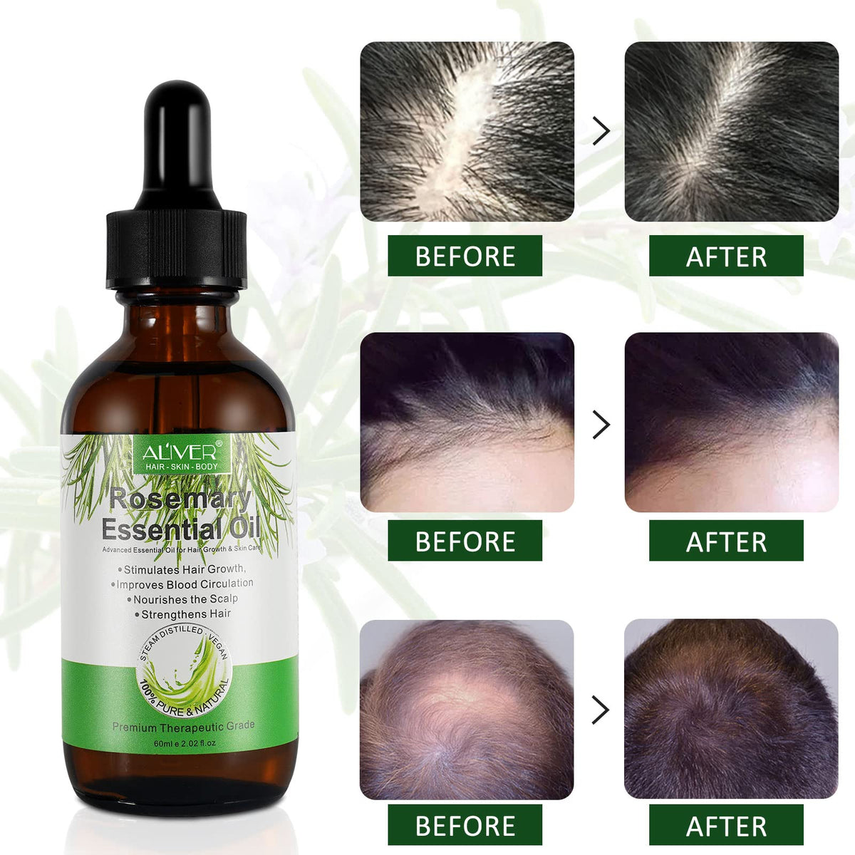 Beyond Happy Rosemary Oil for Hair & Skincare, Vegan Oil Great For Scalpcare, 60ml Natural Hair Oil for Fuller Healthier Hair, Hydrate Your Skin and Face, For Men & Women (Rosemary Oil)