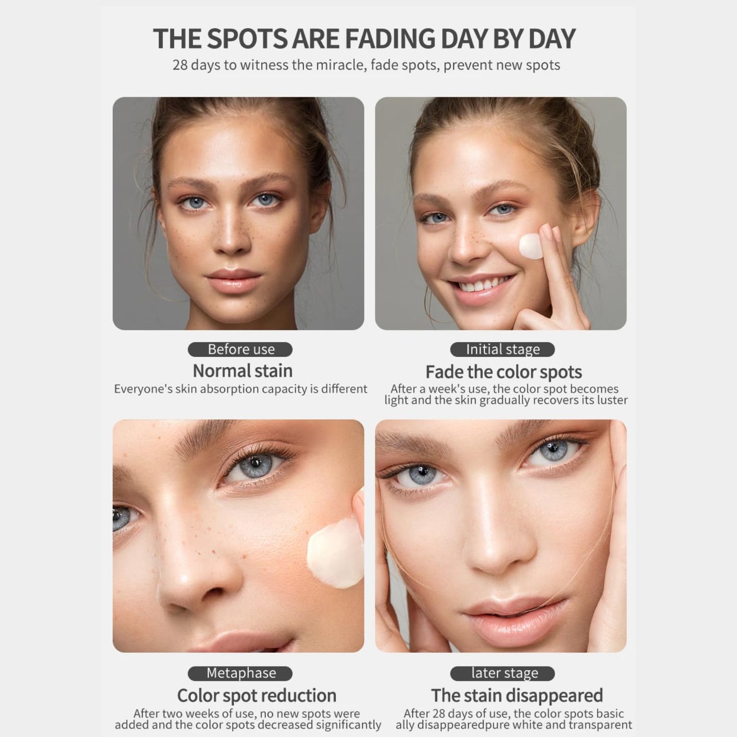 Tianyue Freckle Removal Cream,Anti-Freckle Crea-m- Dark Spot Removal Cream with Niacinamide & Vitamin C,Dark Spot Remover for Face & Body,Whitening Freckl-e Crea-m, Reduces Melasma,Improve Skin Dullness