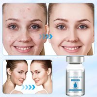 Bettinay 5PCS Micro Infusion Facial System for Lips, Serum Beauty Kit for Repair Skin Deep Nourishment All Skin Types