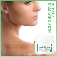 Scar Removal Cream for Face & Body - Treatment for New Scars, Stretch Marks, Acne Spots & C-Sections Treatment Cream, 50g, Natural Formula for Face and Body, Reduces Old and New Scars