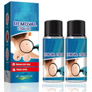 YXtecd 2pcs Skin Tag Removal Kit, 30ML
