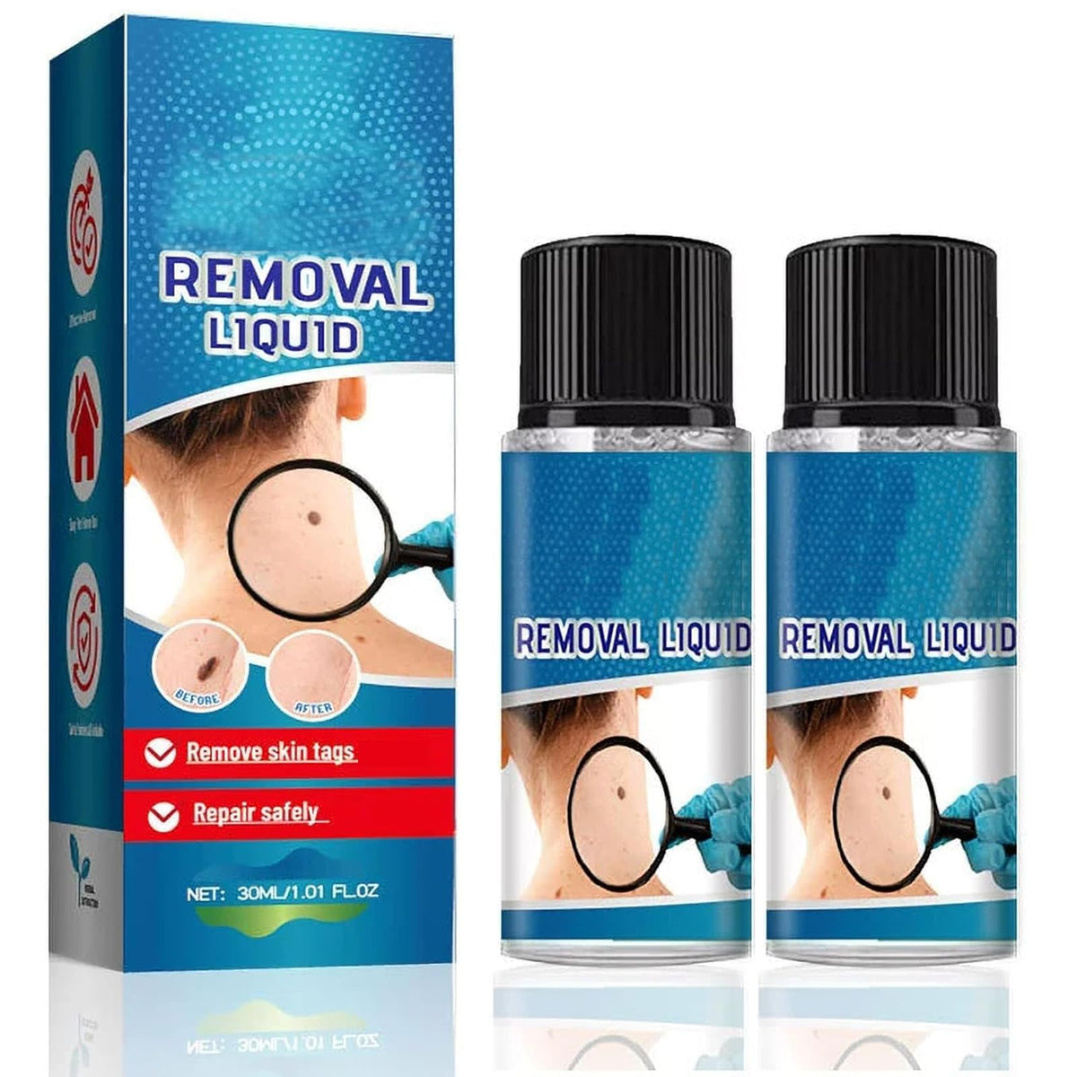 YXtecd 2pcs Skin Tag Removal Kit, 30ML