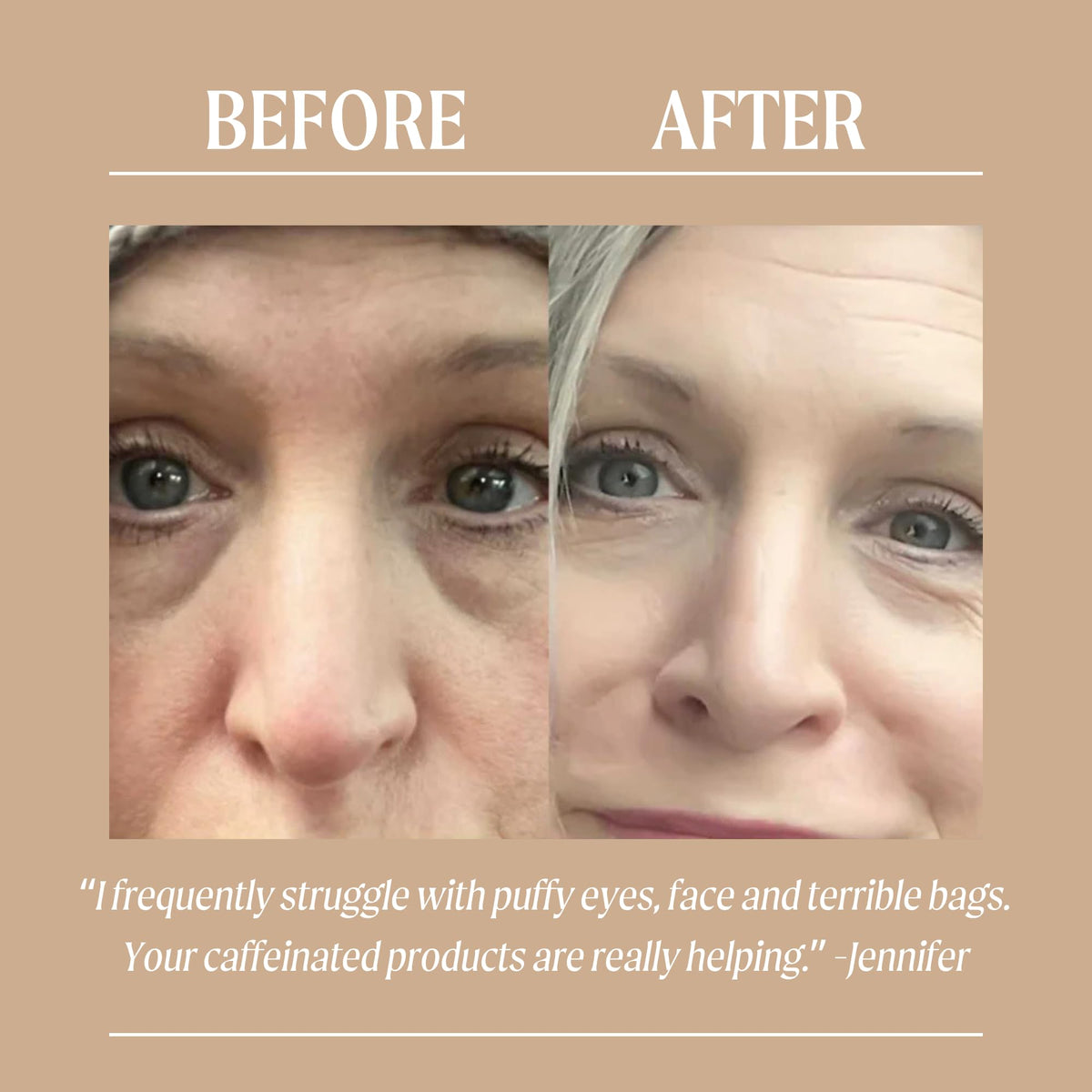 UPCIRCLE UpCircle Eye Cream With Coffee And Hyaluronic Acid 15ml - For Dark Circles, Puffiness + Wrinkles - Glycerin, Maple Bark + Cucumber Extract - Natural, Vegan + Cruelty-Free