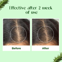 Passion Indulge Hair Proteinz Rosemary Hair Growth Oil with Biotin | Reduce Hair Fall & Hair Breakge - 100 ml | Suitable for all type Hair