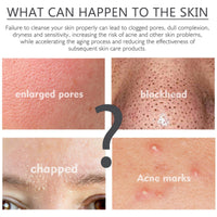 BigyQiu Azelaic Acid 12% Facial Serum Cream,Azelaic Acid Cream with Niacinamide Vitamin C,Brightening Face Skin Care Treatment for All Skin Types,Repair Dark Spots Skincare for Fresher and Smoother Skin