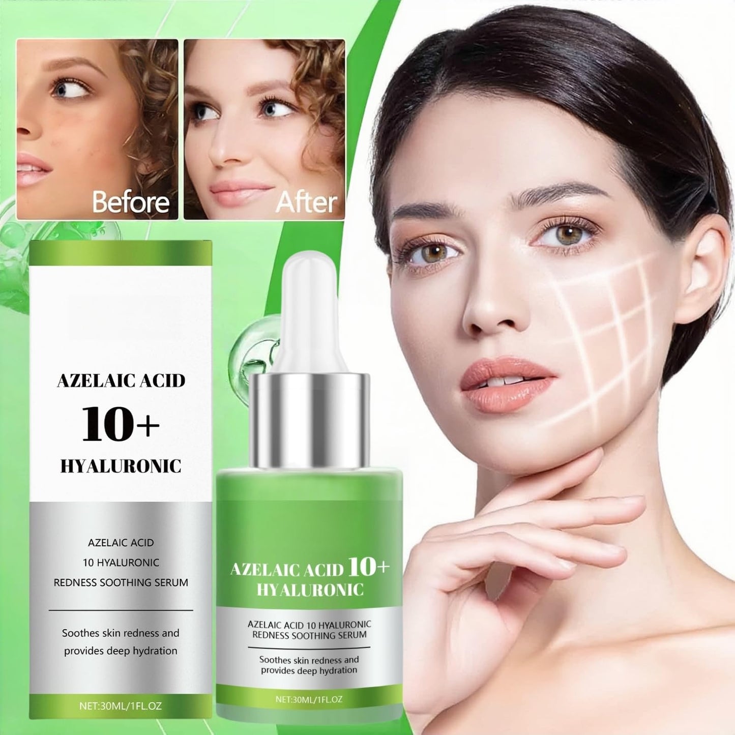 Fankayi Azelaic Acid 10 Hyaluron Redness Soothing Serum,Facial Serum for Sensitive Skin,Dark Spot Correcting Serum,Hyaluronic Acid Serum,Hyaluronic Acid Moisturiser,Gentle and Soothing,Light in Texture