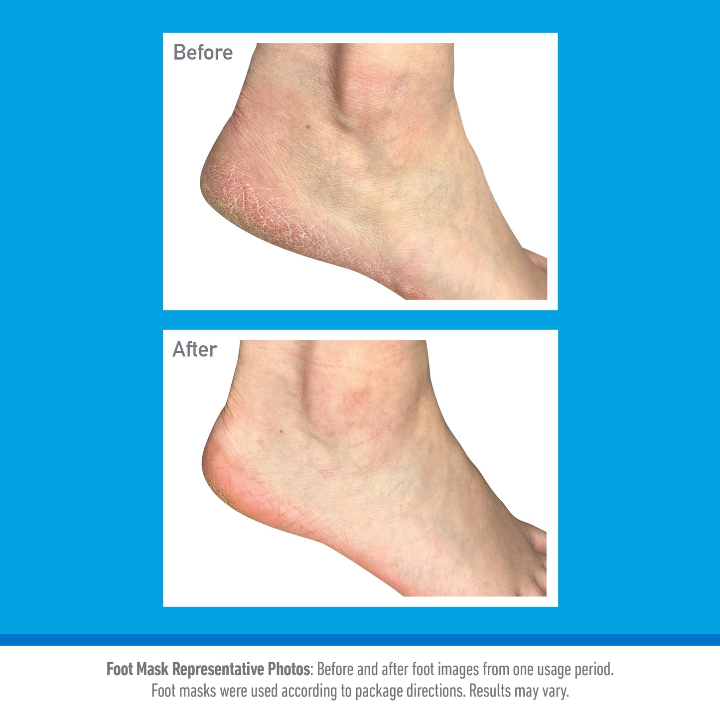 O'Keeffe's O’Keeffe’s Healthy Feet Foot Mask – Intensive Moisturising Sock Treatment for Extremely Dry, Rough Feet & Cracked Heels – Visible Results in One Use (2 Pairs)