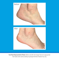 O'Keeffe's O’Keeffe’s Healthy Feet Foot Mask – Intensive Moisturising Sock Treatment for Extremely Dry, Rough Feet & Cracked Heels – Visible Results in One Use (2 Pairs)