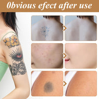 Nadiaen Tattoo Cover up Makeup Waterproof & Sweatproof Tattoo Concealer Full Coverage Body Concealer Hidden Spot Birthmarks Scars for Men and Women