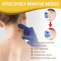ponizno Wart Remover, Skin TagRemovel for Hands and Body Easy to Use Natural & Safe Remover