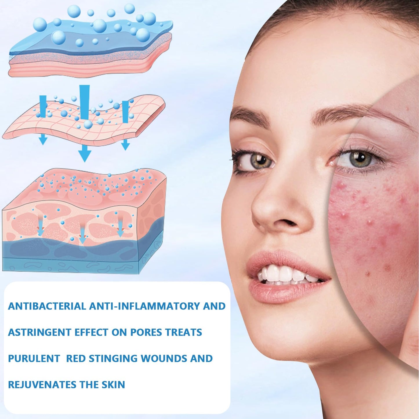 Bettinay 5PCS Micro Infusion Facial System for Lips, Serum Beauty Kit for Repair Skin Deep Nourishment All Skin Types