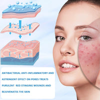 Bettinay 5PCS Micro Infusion Facial System for Lips, Serum Beauty Kit for Repair Skin Deep Nourishment All Skin Types