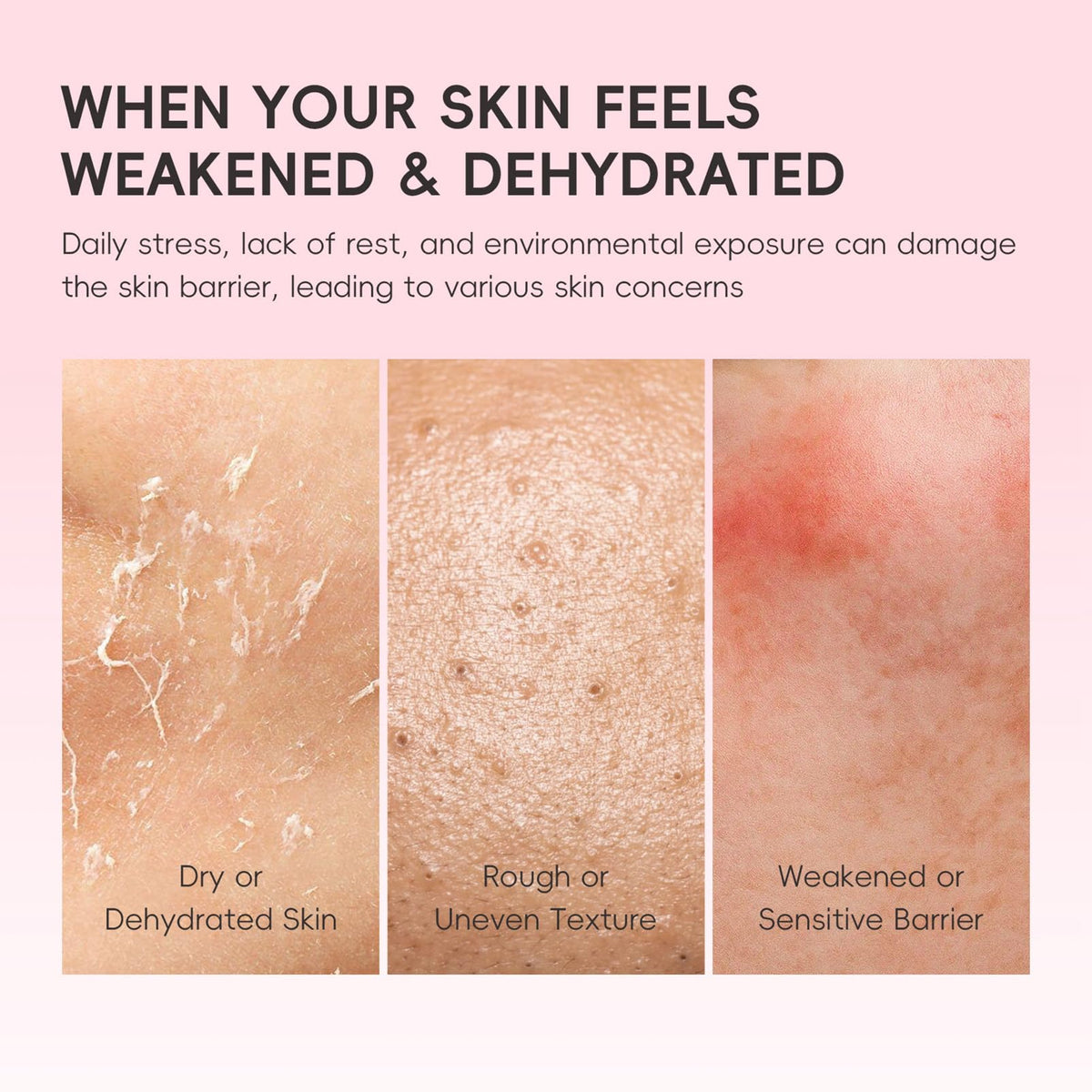 Fashion Base Skin Care For Teenage Girls,Sakura Skincare Set (Sakura-5PCS)