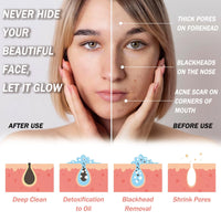 HOKIAMCN Dead Sea Mud Mask with Aloe Vera Spa Quality Natural Facial Mask Deep Pore Reducer for Face and Body Acne Blackheads Blemish Oily Skin Wrinkles Vegan Cruelty-Free Cosmetic Mineral-Rich