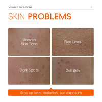 INSKIN Vitamin C Moisturiser For Face, Vitamin C Cream, Moisturiser Face Women, Anti Aging & Wrinkle Day And Night Cream For Women & Men, to Reduce Uneven Skin Tone,Fine Lines for Skin Care