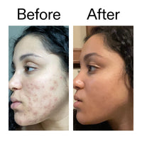 The INKEY List 2% Tranexamic Acid Serum 30ml