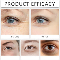 Castor and Frankincense Rollerball Eye Cream for Dark Circles, Puffy Eyes - Anti-Aging Eye Care with Castor Oil