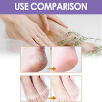 OlymGrow 2-Pack Foot Peel Mask – Callus Remover & Exfoliator for Soft, Smooth Feet, Repair Cracked Heels, Remove Dead Skin, Peeling Foot Mask for Hard, Dry Skin