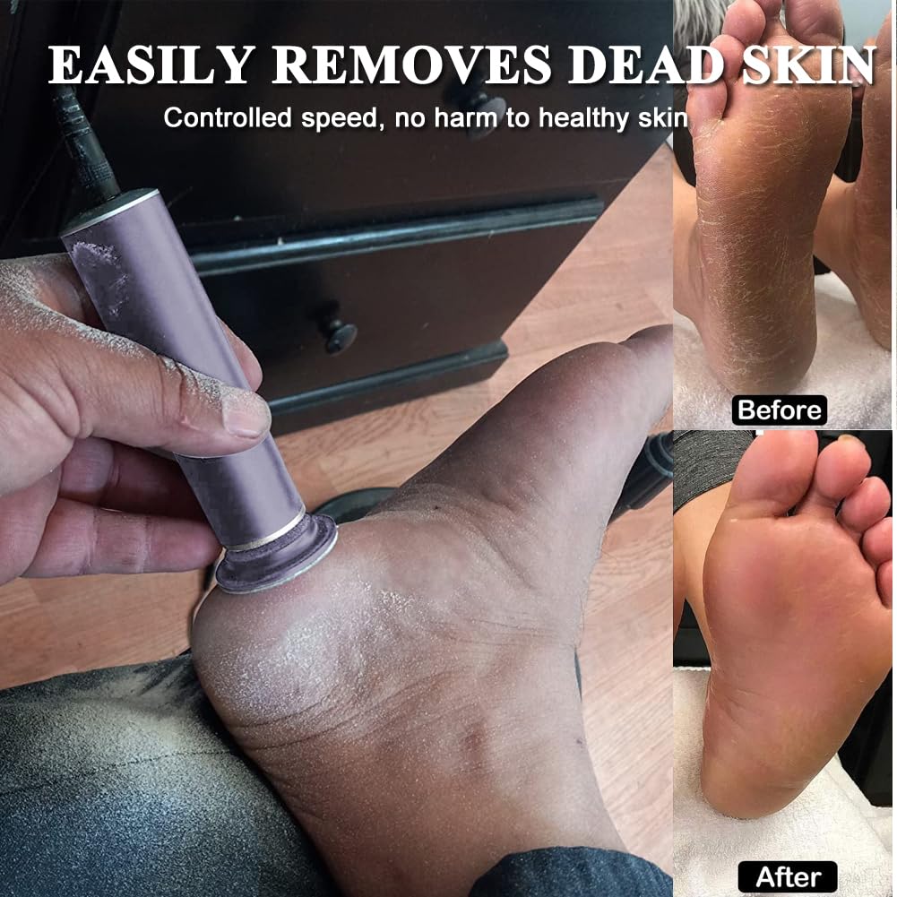 AONOLOVO Electric Foot File Hard Skin Remover, Powerful Electric Callus Remover Foot Sander Pedicure Tools Dead Skin Remover, Speed Adjustable, with 60pcs Replacement Sandpaper (Gray)