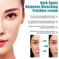 Nadiaen 2 Pcs Dark Spot Remover for Face,Age Spot Remover Hyperpigmentation Treatment-Sun Spots and Melasma Treatment Cream for Face, Pigmentation Freckle Removal Cream