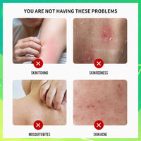 Athlete's foot Treatment cream - anti fungal foot cream for dry Feet, cracked heel Treatment & Athletes foot cream extra strong