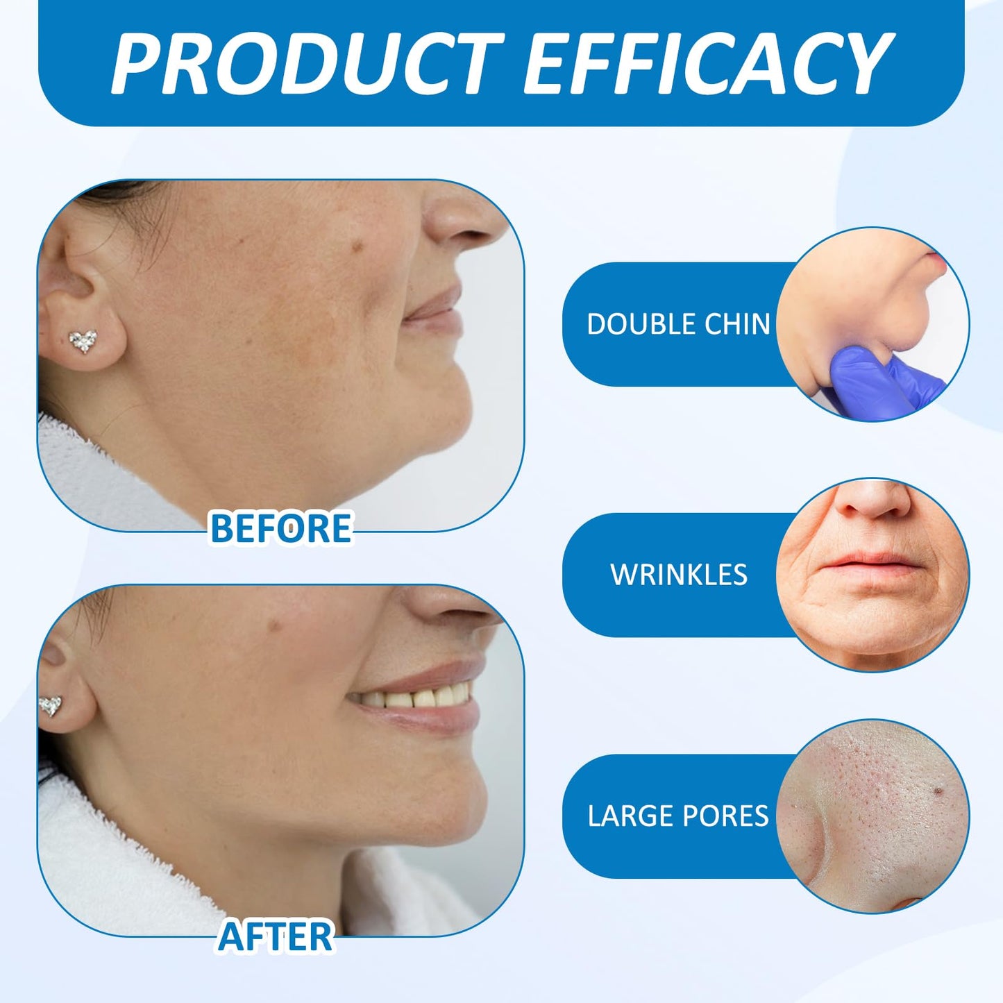 ExcellaElite 3 Pcs of V Line Face Lifting Chin Mask Strap for Double Chin Lifting Mask Multiple Active Ingredients Firming Skin Lifting Facial Skin