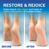 Dr. Scholl's Cracked Heel Complete Cream with Repair K+, 60ml - Moisturising Treatment Cream for Cracked Heels and Dry Skin with Keratin- 1 x 60 ml
