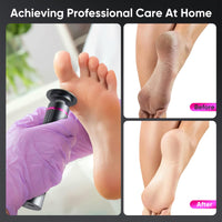 VIHBRAI 2-in-1 Electric Foot Callus Remover & Nail File 9-Speed LCD Pedicure Kit with 13000 RPM 2400mAh Dual Rotation (P/F/R) 3 Sanding Heads & Toe Grinder Hard Skin Remover for Feet & Nails