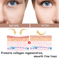 Anti Wrinkles Face Moisturiser Balm,Instant Wrinkle Multi Balm,Collagen Boosting Moisture Balm Stick,Smooth Fine Lines & Anti Aging,Wrinkle Fillers That Work,Diminish Eye & Face Wrinkles-For All Skin