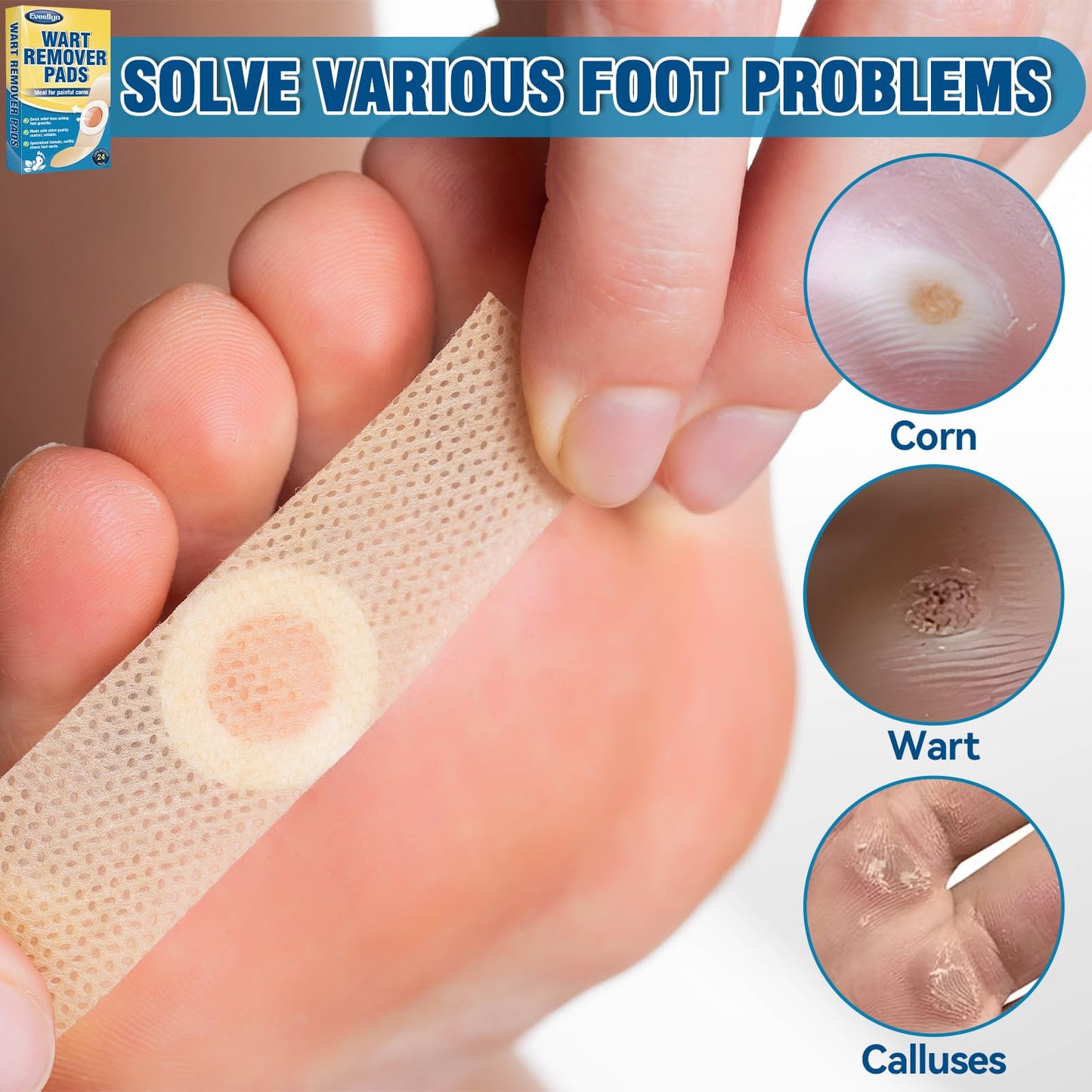 Eveellyn Wart Removal