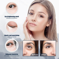 SingHao 2 Pcs Lutein Eye Essence Oil,Lutein Eye Wrinkle Essence Oil,Vitamin C Lutein E/ye Essen/ce O/il,Vc E/ye Wrinkle Essen/ce O/il,Lu/tein Essential O/il,L/utein Rollerball Ess/ence,E/ye Bags Remover
