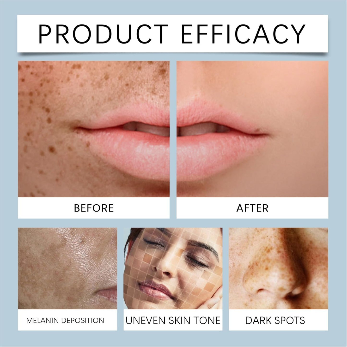 Spot-lightening Gel,Skin Tightening Cream,Skin Brightening Face Serum for Discolouration and Hyperpigme/ntation,Vitamine C&Hyaluronic Acid Face Serum,Face Brightening Serum,for All Skin Types,30ml