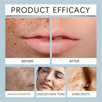 Spot-lightening Gel,Skin Tightening Cream,Skin Brightening Face Serum for Discolouration and Hyperpigme/ntation,Vitamine C&Hyaluronic Acid Face Serum,Face Brightening Serum,for All Skin Types,30ml