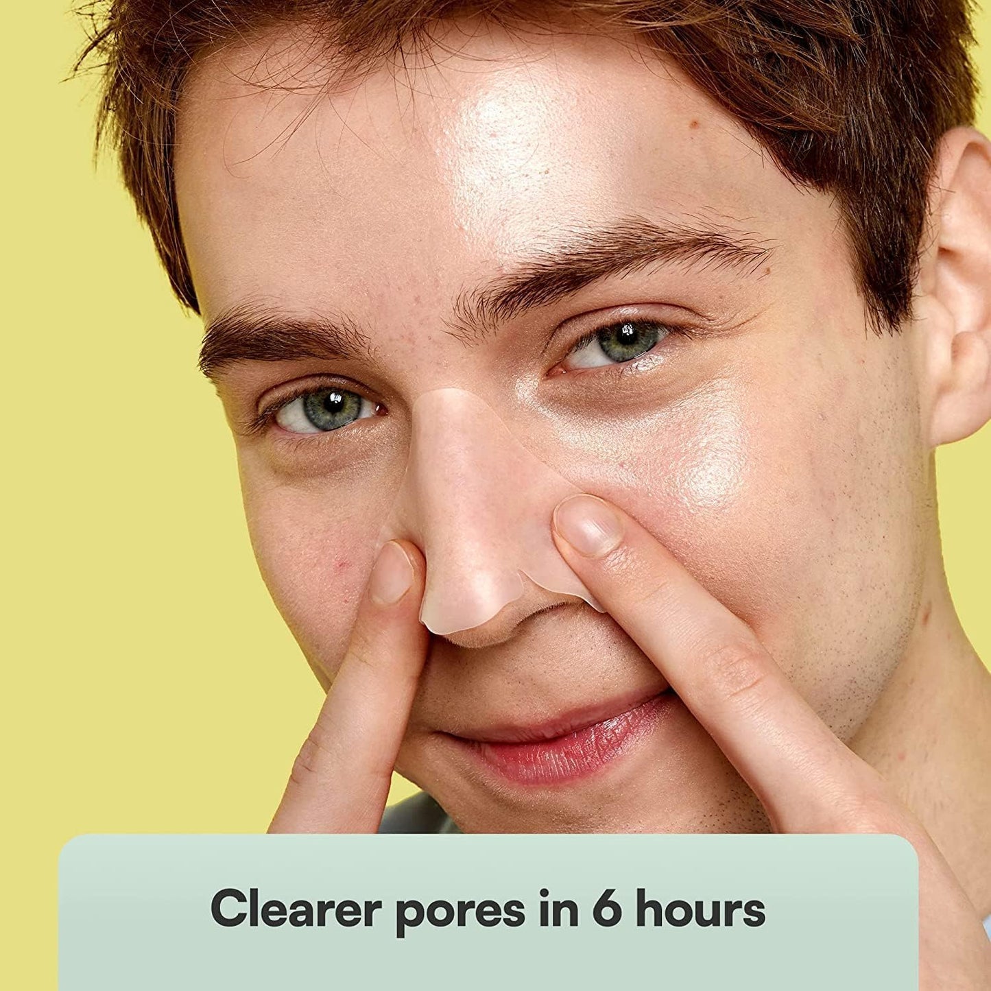 SKIN CHOICE Classic Nose Pore Strips Blackheads Hydrocolloid Patches, 5 Ct