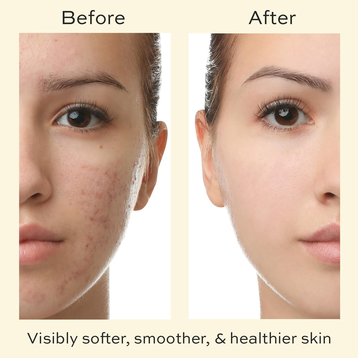The Natural and Organic Family Face Cream for Pre Teens & Teens - Organic Face Moisturizer for Dry Skin - Soothing Facial Cream with Tea Tree Moisturizer - Daily Face Moisturizer for Acne Prone Skin - Hyaluronic Acid Moisturizer