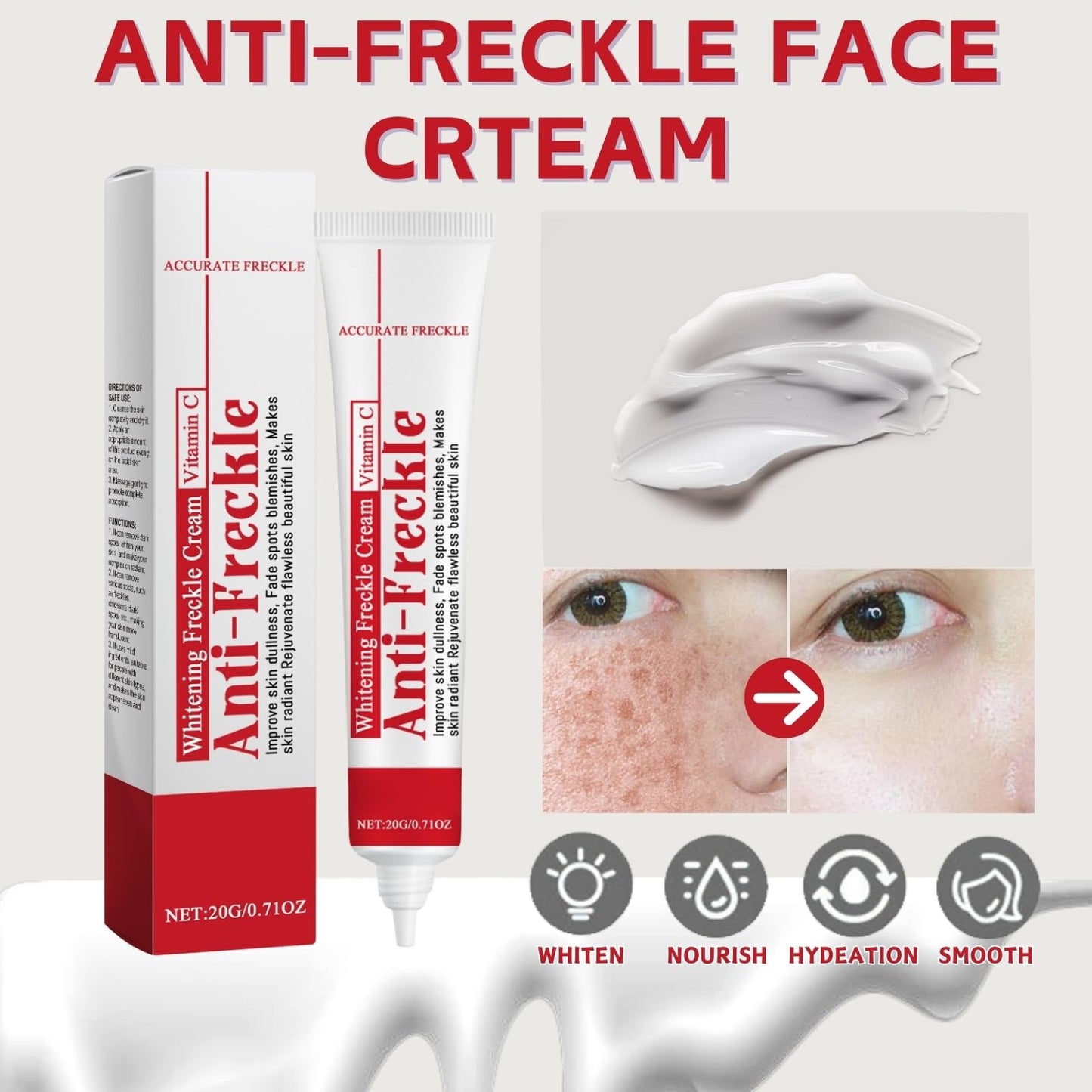 Freckle Removal Cream - Whitening Cream for Face - Whitening Freckle Creams for Acne Scar Removal - Anti Pigmentation Face Creams - Pigmentation Removal Face Creams - Face Cre-am for Women