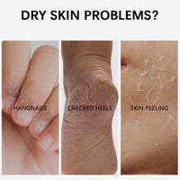 NLFOX Foot Cream - Cracked Heel Repair Cream - Foot Care Cream for Very Dry Feet & Hands - Foot Cream for Cracked Heels and Dry Skin Deep Moisturizing,Callus Remover Nourishes Soften