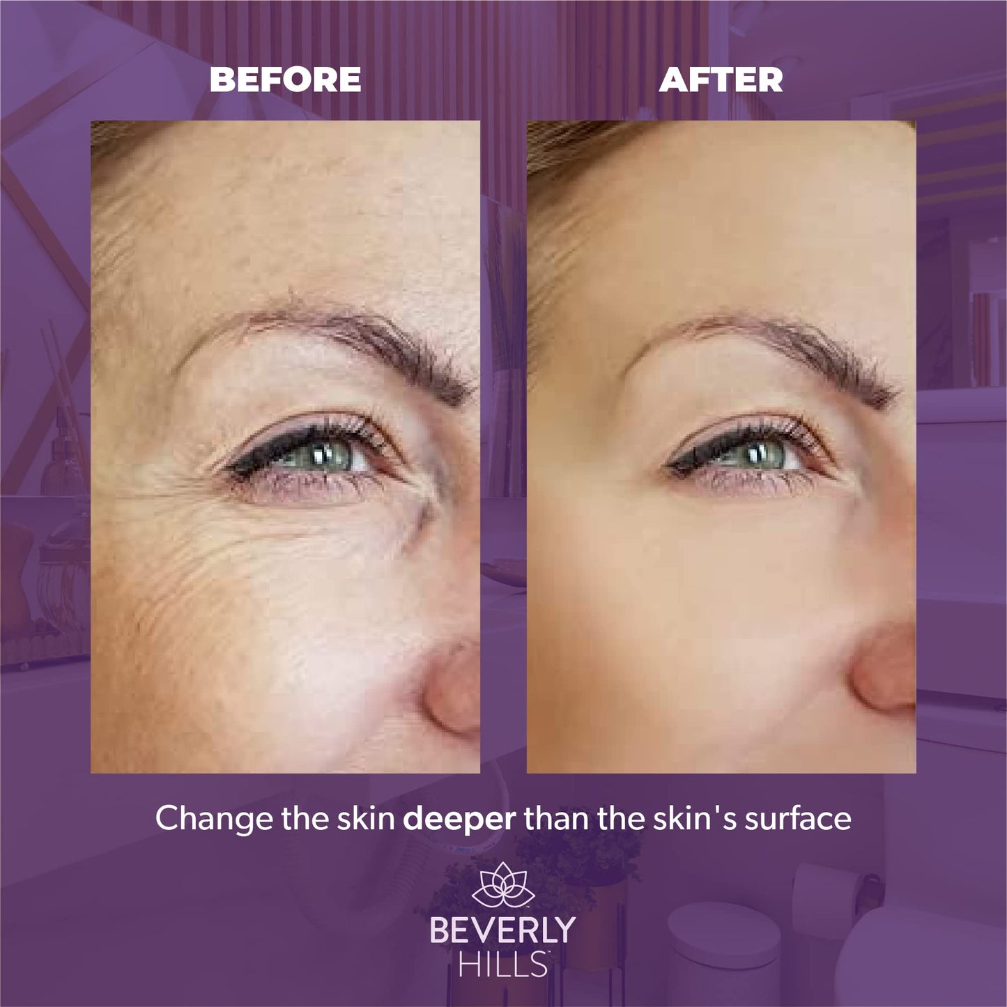 BEVERLY HILLS Anti Aging Collagen Face Cream with EGF & Multi Peptide for Wrinkle Repair & Skin Rejuvenation, Anti Ageing Cream for Cell Repair & Collagen Production for Men & Women, 60Day Supply 30ML