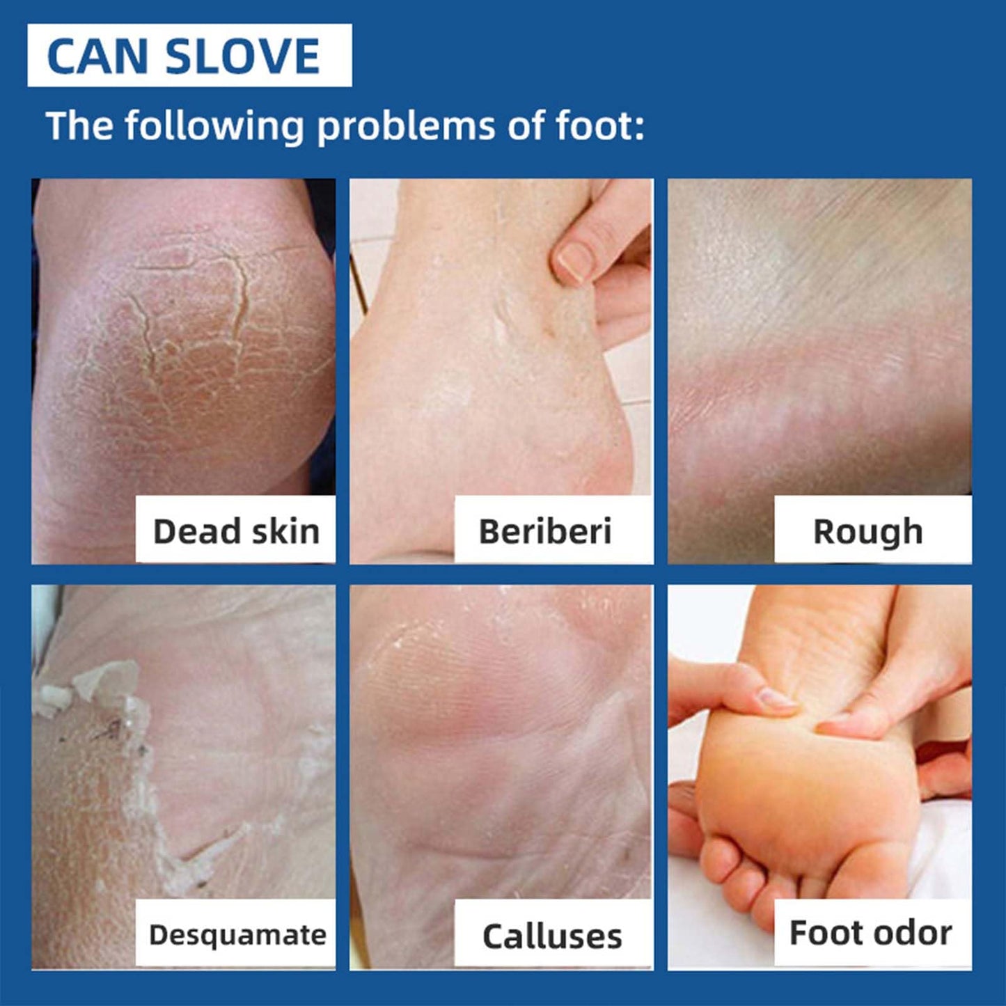 NLFOX Urea Foot Cream - Urea Cream for Cracked Heels and Dry Skin - Urea Cream 40% for Feet - Deep Moisturizing Foot Cream Treatment Maximum Strength Urea cream for Callused Rough Skin