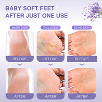 7PCS Foot Peel Mask for Hard Skin & Feet Scrubber & Socks, Exfoliating Foot Peel Mask, Callus Remover for Feet, Foot Moisturiser Socks for Foot Care