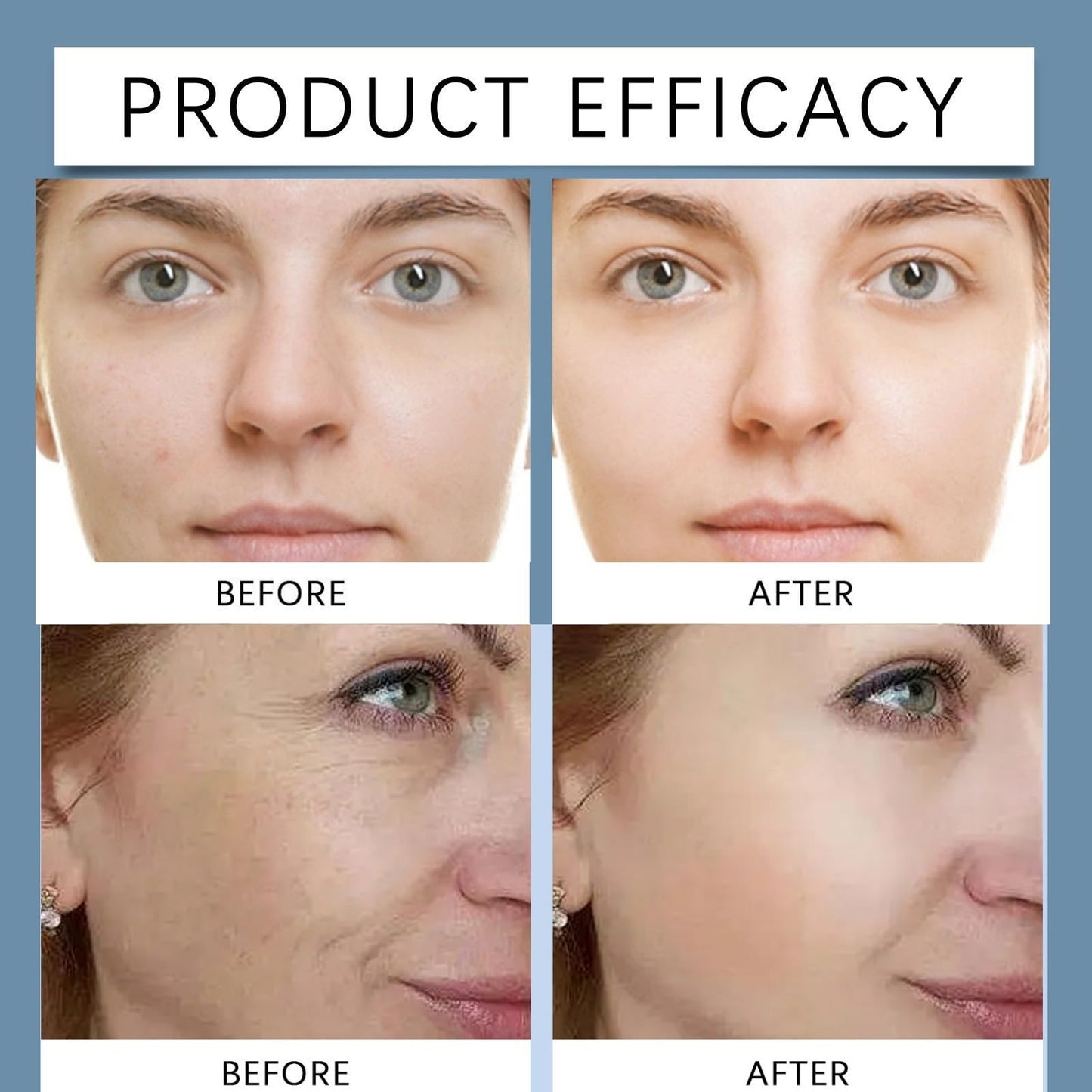 Hyaluronic Acid Powder,Natural Hyaluronic Acids Serum,Hyaluronic Acid Powder Serum,Hyaluronic Ac/id Pow/der for Skincare,Diy Facial Serum,Hyaluronic Ac/id Moisturizer,Water-Soluble for Skin Moisture