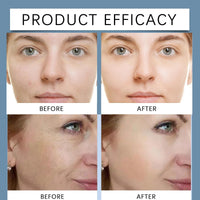 Hyaluronic Acid Powder,Natural Hyaluronic Acids Serum,Hyaluronic Acid Powder Serum,Hyaluronic Ac/id Pow/der for Skincare,Diy Facial Serum,Hyaluronic Ac/id Moisturizer,Water-Soluble for Skin Moisture