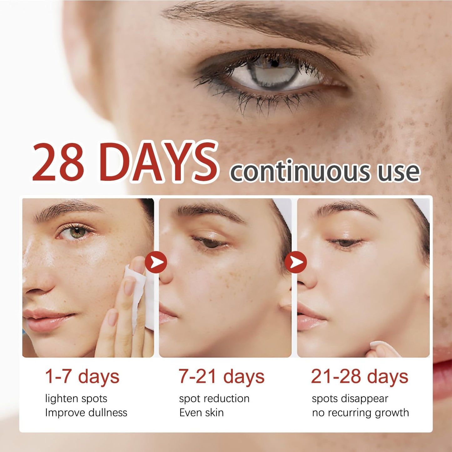 Kojic Acid Cream,Dark Spot Remover for Face,Skin Lightening Cream for Anti Aging,Dark Spot Correcting Glow Serum,Face Moisturizer for Women,Pigmentation Removal Cream,Freckle Removal Cream,Dark Spots